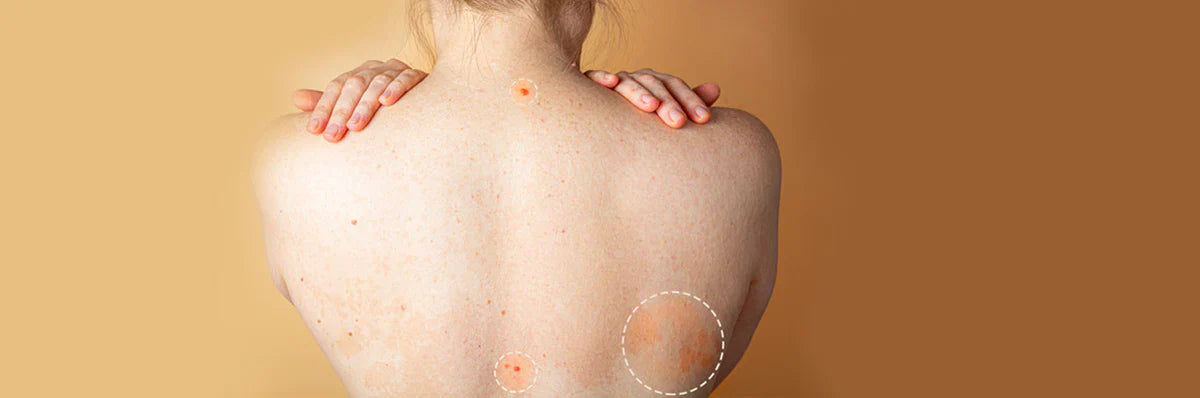 Skin Conditions You Should Know About – Skinstore