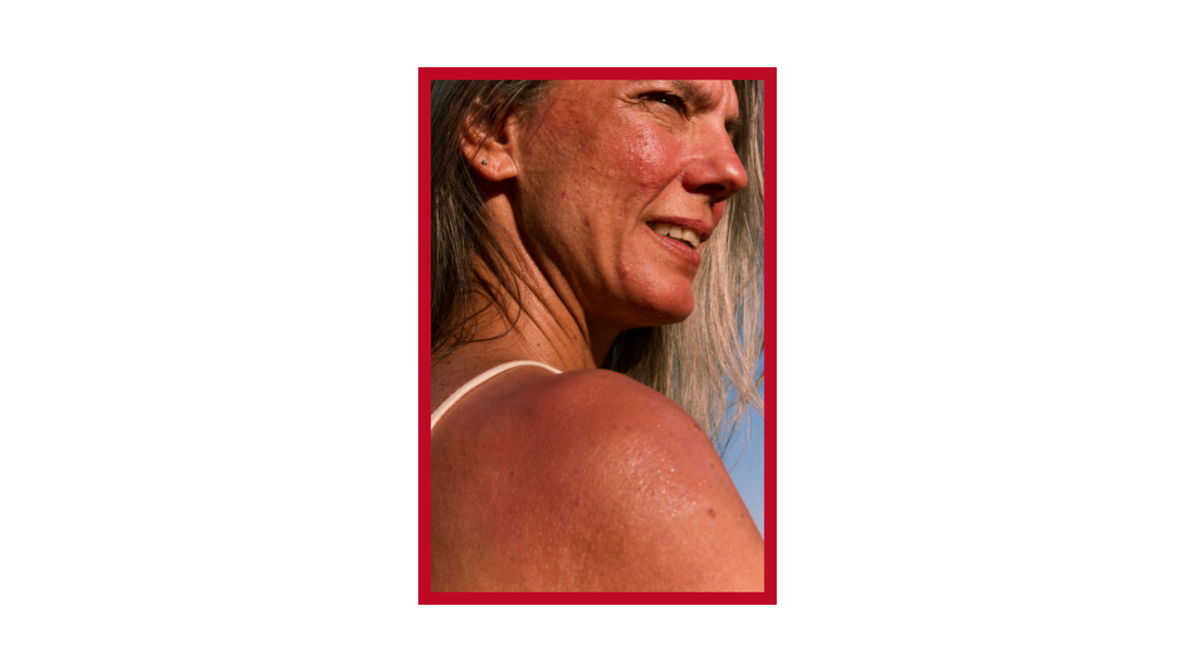 Soothe the Flare: Coping with a Sensitive skin
