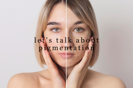 Let’s Talk About Pigmentation